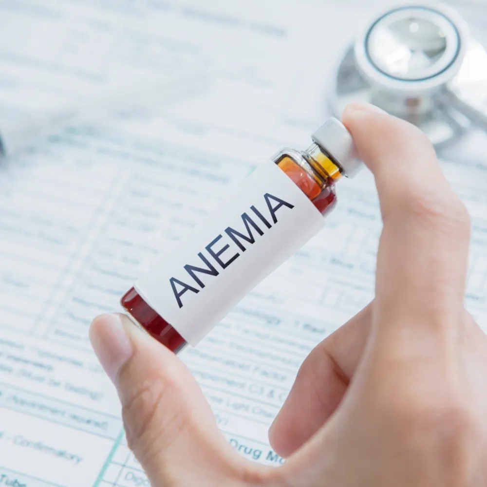 Anemia and MDS, What You Need To Know image