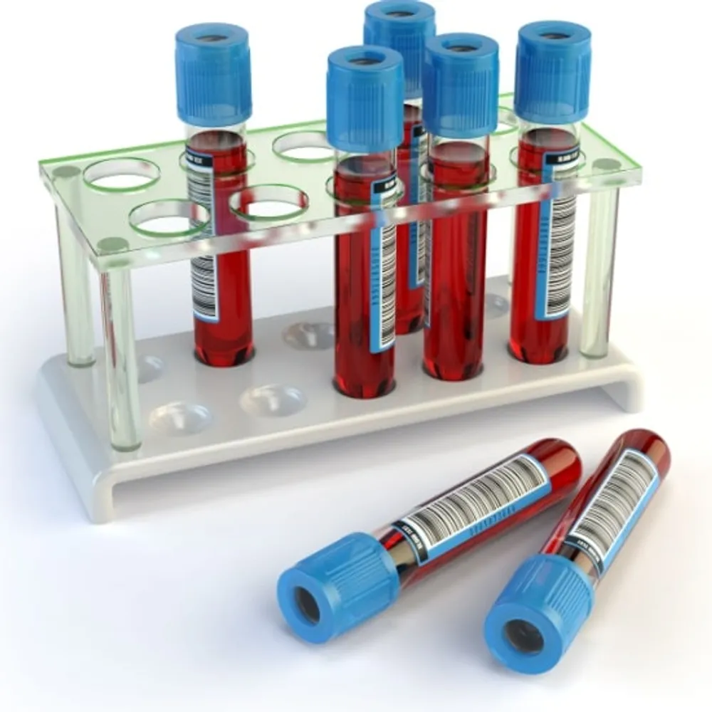 Understanding Lab Values image