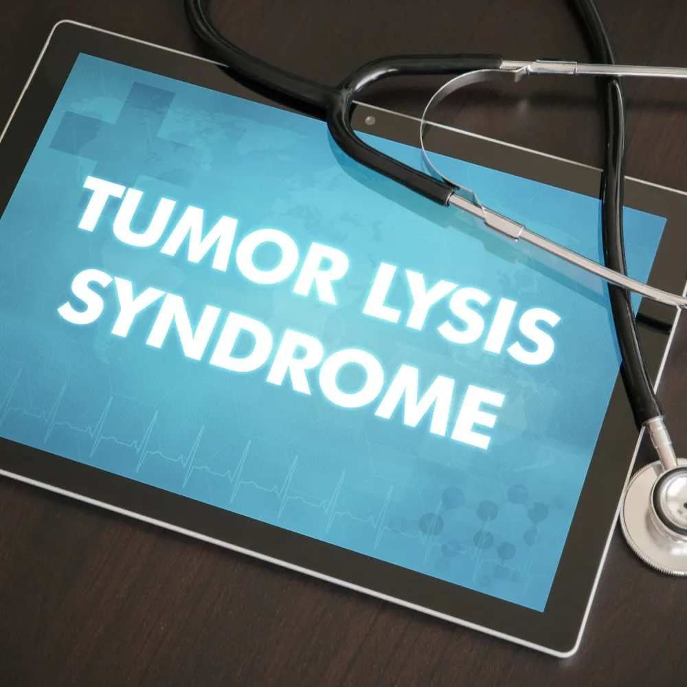 All About Tumor Lysis Syndrome in DLBCL image