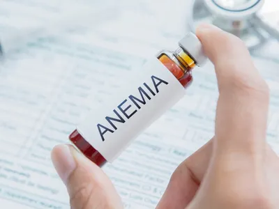 Anemia and MDS, What You Need To Know image