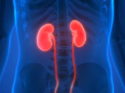 Acute Kidney Injury (AKI) and Chronic Kidney Disease (CKD) image