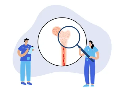 What You Need to Know About Myelofibrosis image