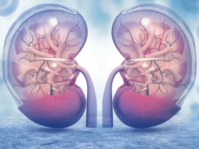 What Is MGRS And How Does It Affect My Kidneys? image