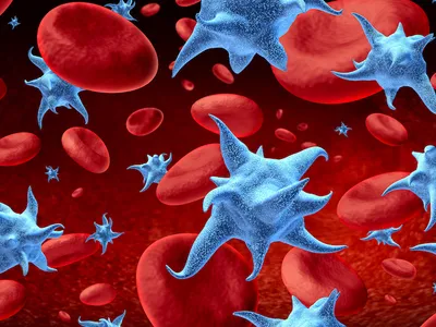 Managing Low Platelet Levels in Blood Cancers image