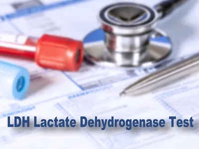 Tests for CLL Patients: Lactate Dehydrogenase (LDH) image