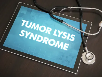 What is Tumor Lysis Syndrome? image