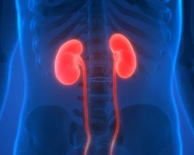 Acute Kidney Injury (AKI) and Chronic Kidney Disease (CKD) image