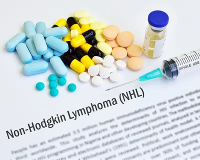 Non-Hodgkin Lymphoma: Understanding Your Diagnosis (Aggressive vs. Indolent) image