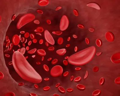 What Does Erythrocytosis Mean? image