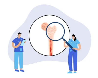 What is Early Primary Myelofibrosis? image