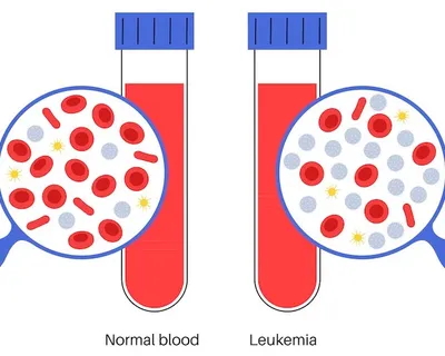 What Is The Difference Between Chronic And Acute Leukemia? image