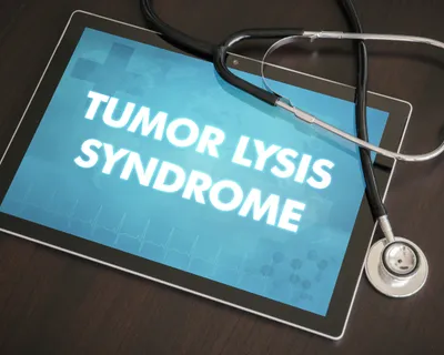 What is Tumor Lysis Syndrome? image