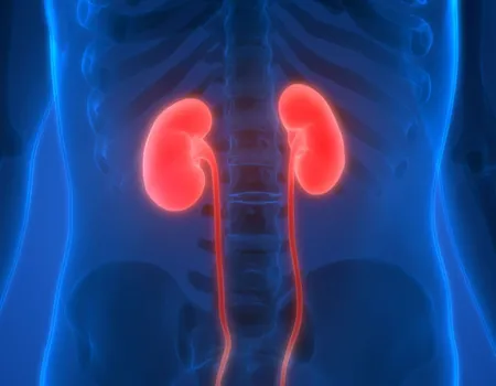 SuPAR And Kidney Inflammation