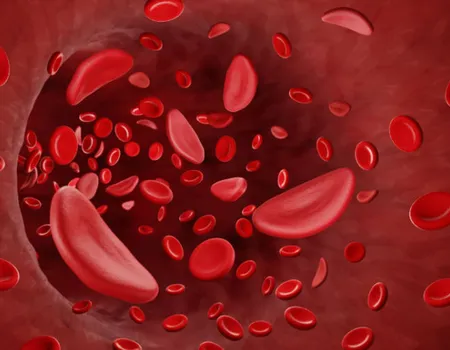 What Does Erythrocytosis Mean?