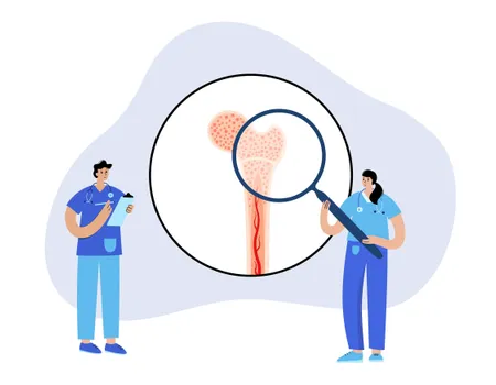 What You Need to Know About Myelofibrosis