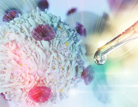 Making CAR-T Therapy Safer and More Accessible for DLBCL Patients