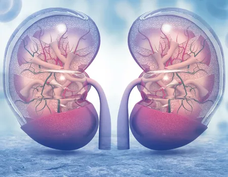 What Is MGRS And How Does It Affect My Kidneys?