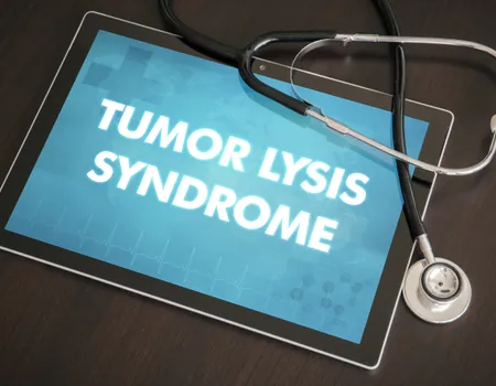 What is Tumor Lysis Syndrome?