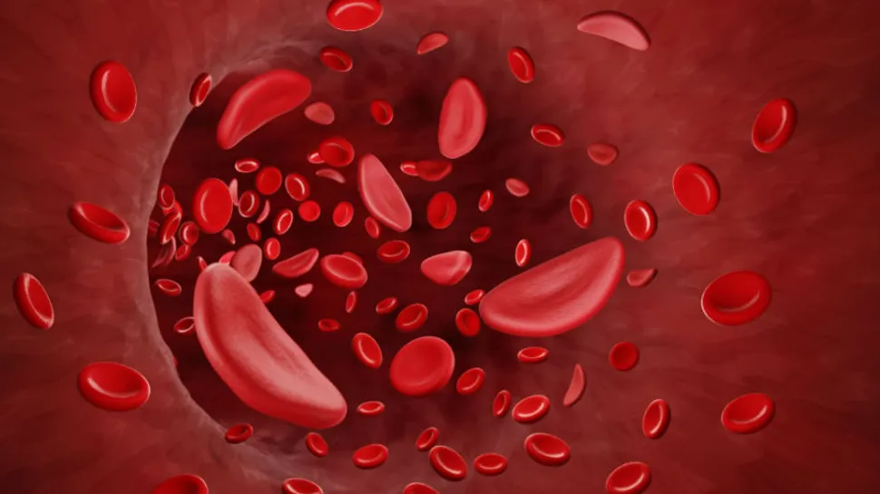 What Does Erythrocytosis Mean? image