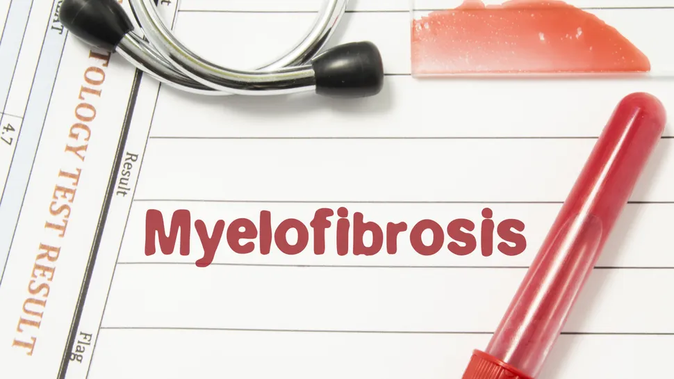 What Is The Prognosis Of A Myelofibrosis Patient? image