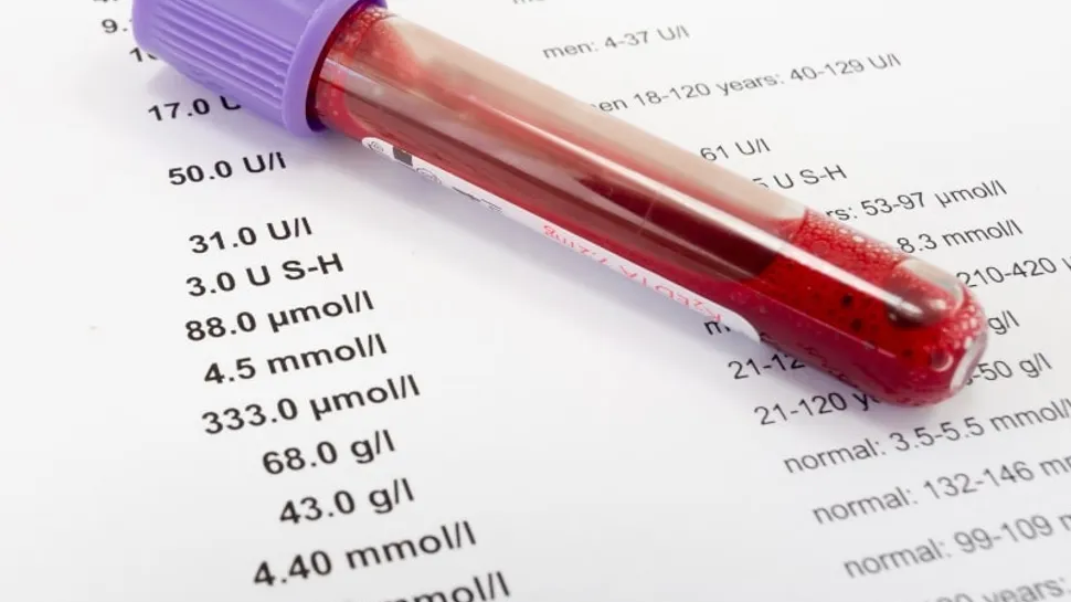 The Promising Treatment Of Imetelstat And Transfusion Independence image