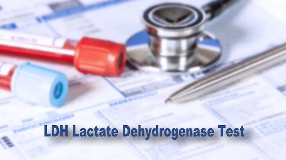 Tests for CLL Patients: Lactate Dehydrogenase (LDH) image