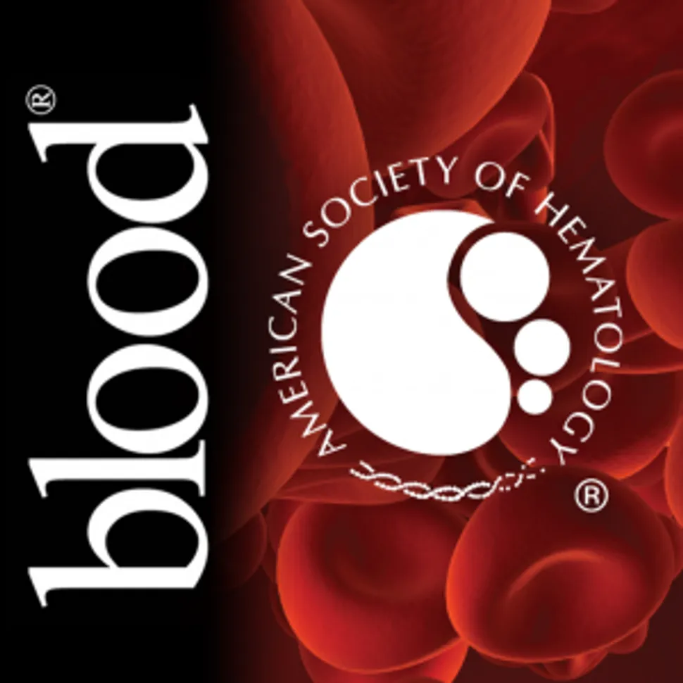 Journal Blood: Pyk2 promotes tumor progression in multiple myeloma image