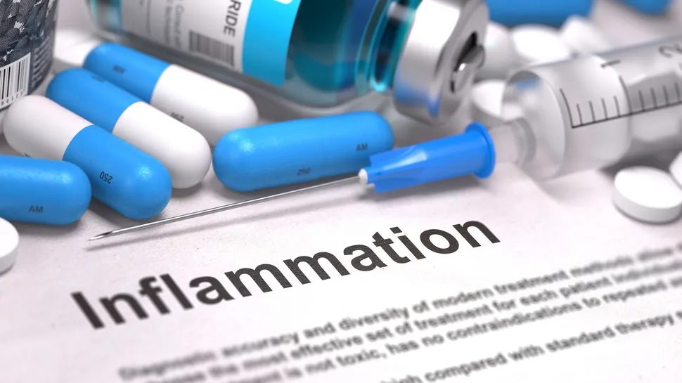 Controlling Inflammation and Myeloma...The Nerve! image