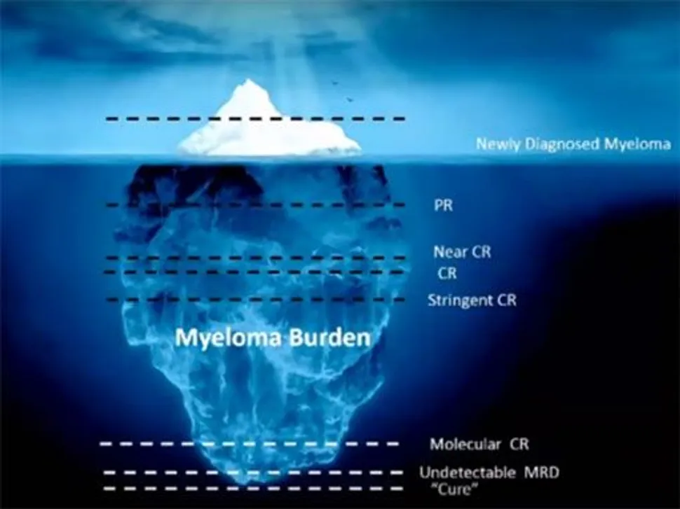 Lack of Minimal Residual Disease Means Longer Life for Myeloma Patients image