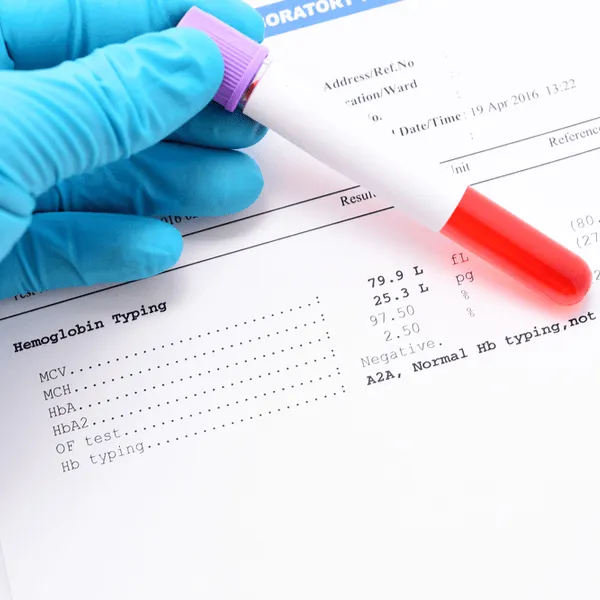 Understanding your AML Labs (and BMB Results) image