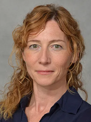 NAM-Natural Killer Cells with Elotuzumab by Viktoria Bachanova, MD, PhD, University of Minnesota image