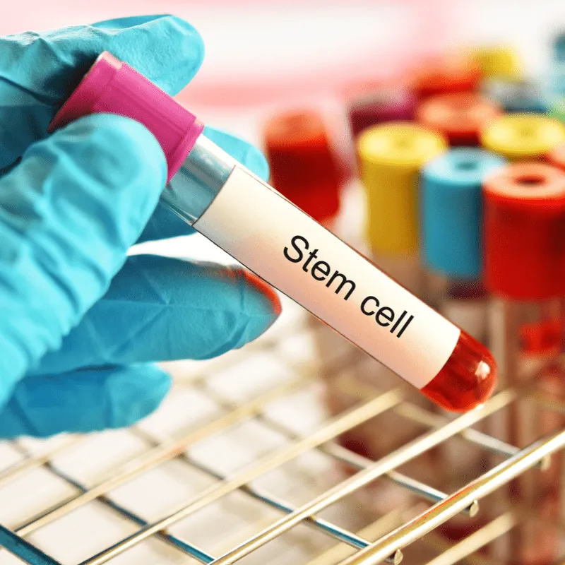 The Role of Allogenic Transplants in Myeloma with Dr. Matthew Fero, UNM image