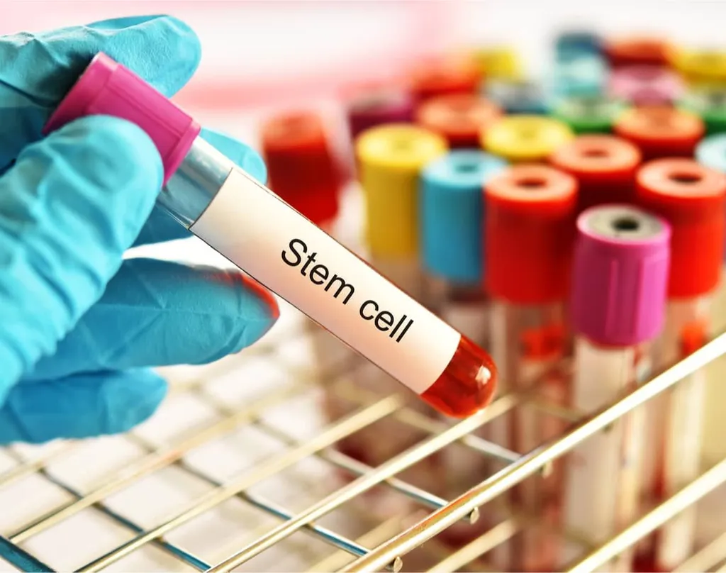Navigating the AML treatment landscape for patients who can and cannot receive a transplant  image