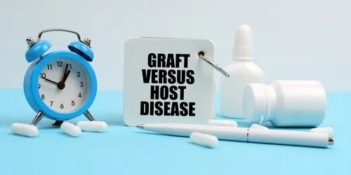 New Treatment for Reducing the Risk of Graft Versus Host Disease After Allogeneic Stem Cell Transplant image
