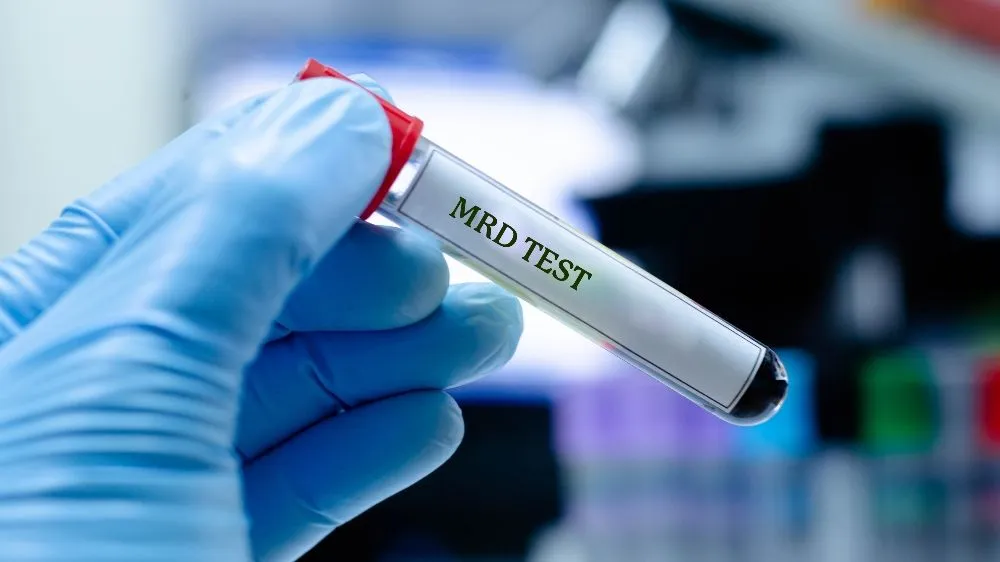 MRD Testing in Newly Diagnosed Myeloma Patients: A Path to Better Outcomes image