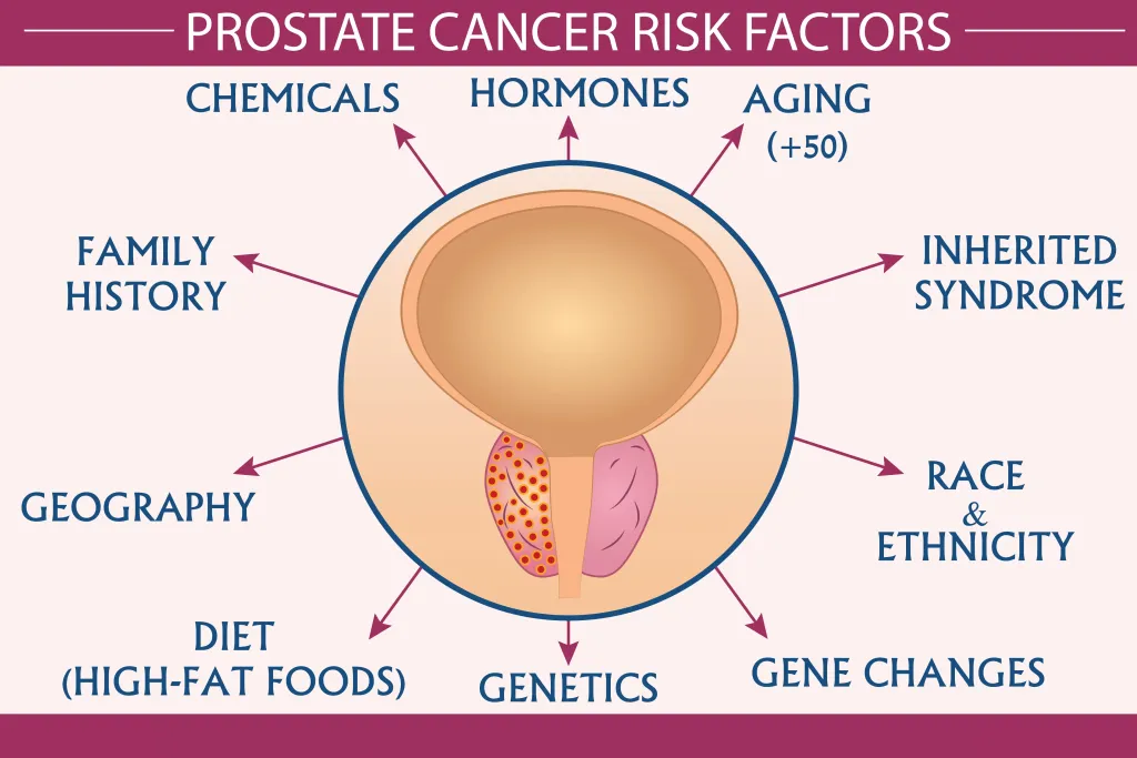101 page: Risk Factors for Prostate Cancer