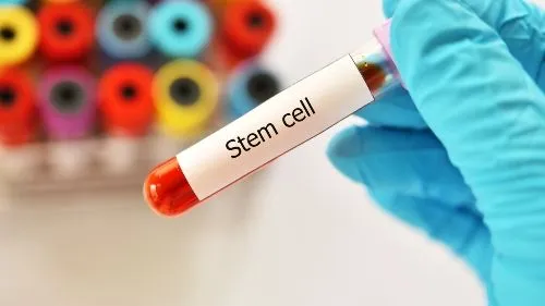 What Mobilizing Agents Are and What They Mean for Your Stem Cell Collection image
