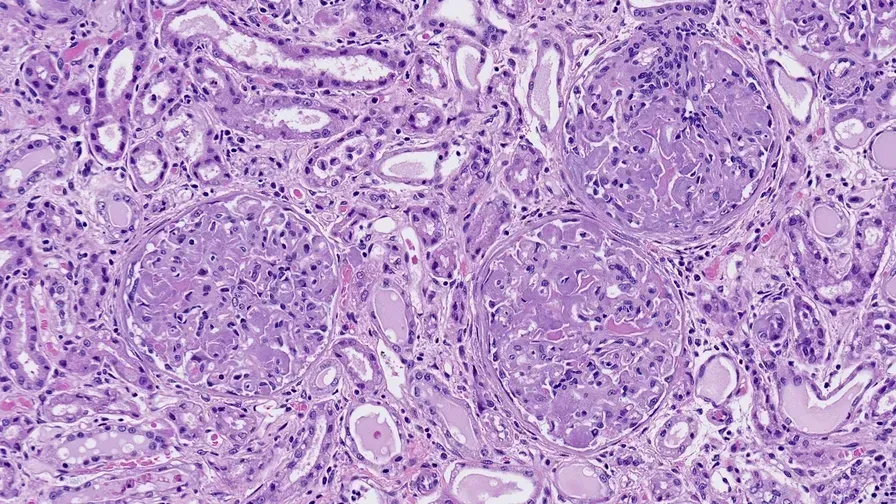 HealthTree Research Results: Causes of a Delayed Diagnosis in AL Amyloidosis image