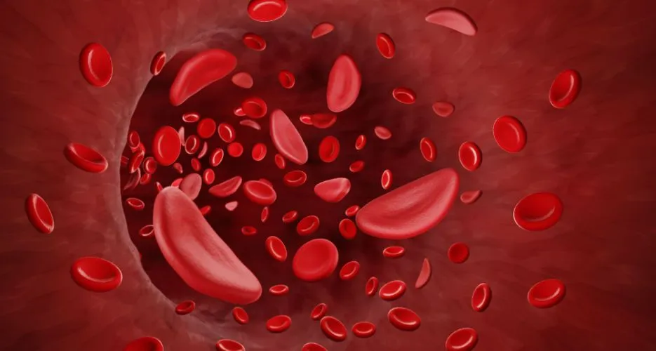 Momelotinib May Reduce Transfusions and Improve Quality of Life image