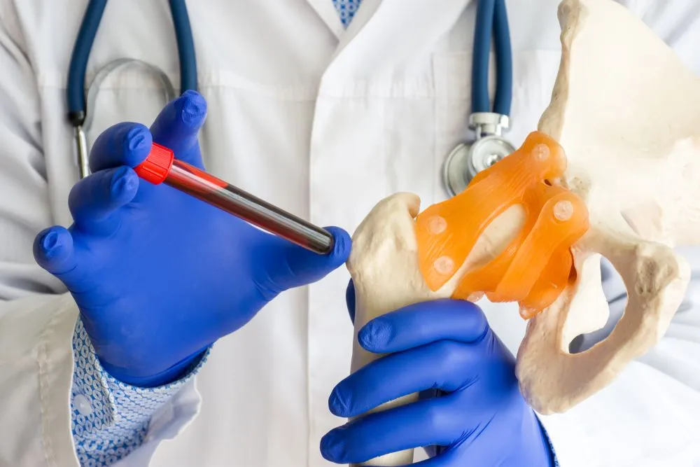 What Are The Differences Between Cytopenic And Proliferative Myelofibrosis? image