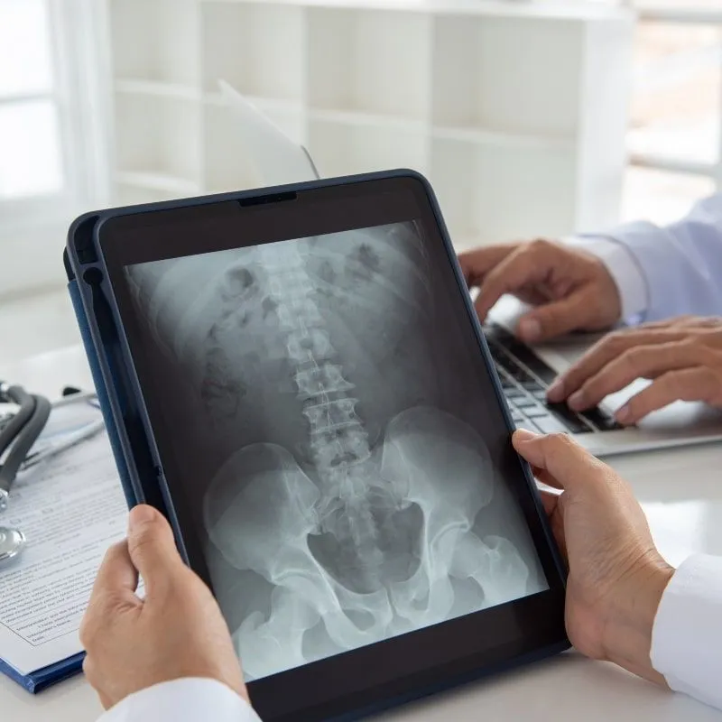 Florida Myeloma Community Event: A Discussion on Bone Health image