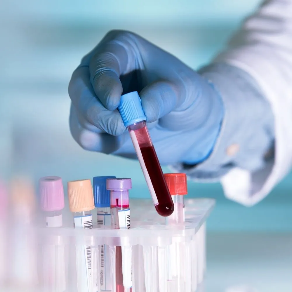 What do Myelofibrosis Tests Tell Your Doctor? with Dr. Srinivas Tantravahi image
