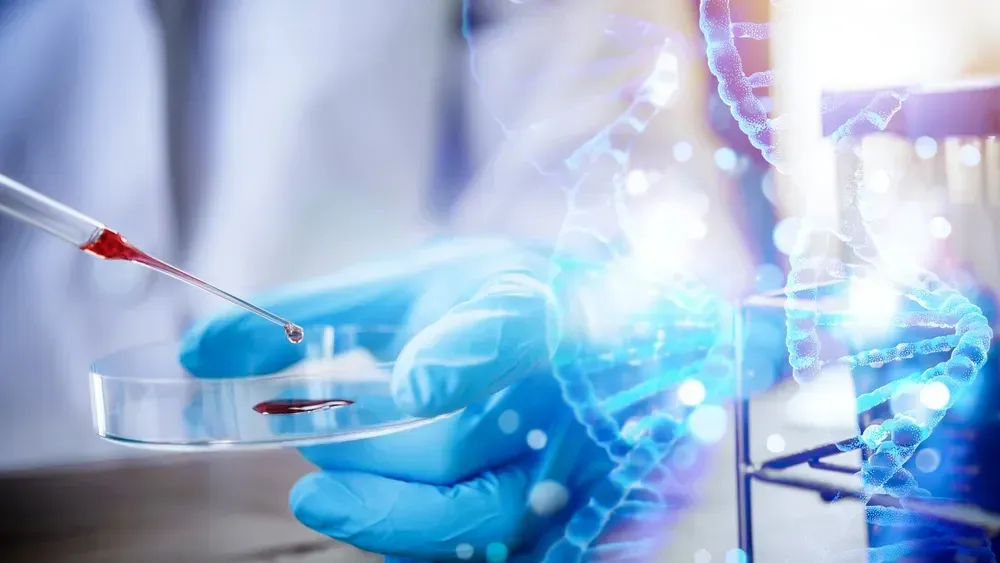 Monitoring Non-Secretory Myeloma image