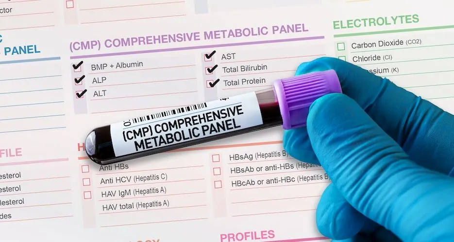 Comprehensive Metabolic Panel for CLL Patients image
