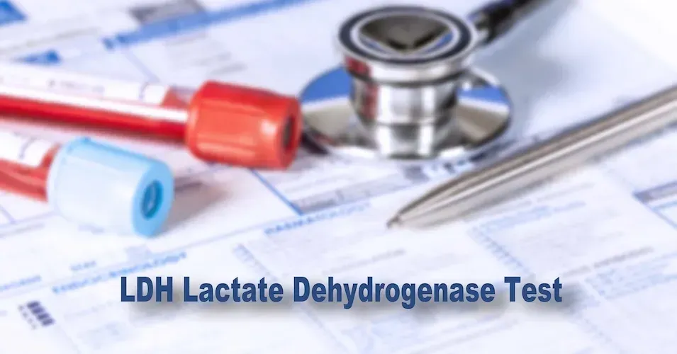How Is the Lactate Dehydrogenase (LDH) Test Used for Lymphoma? image