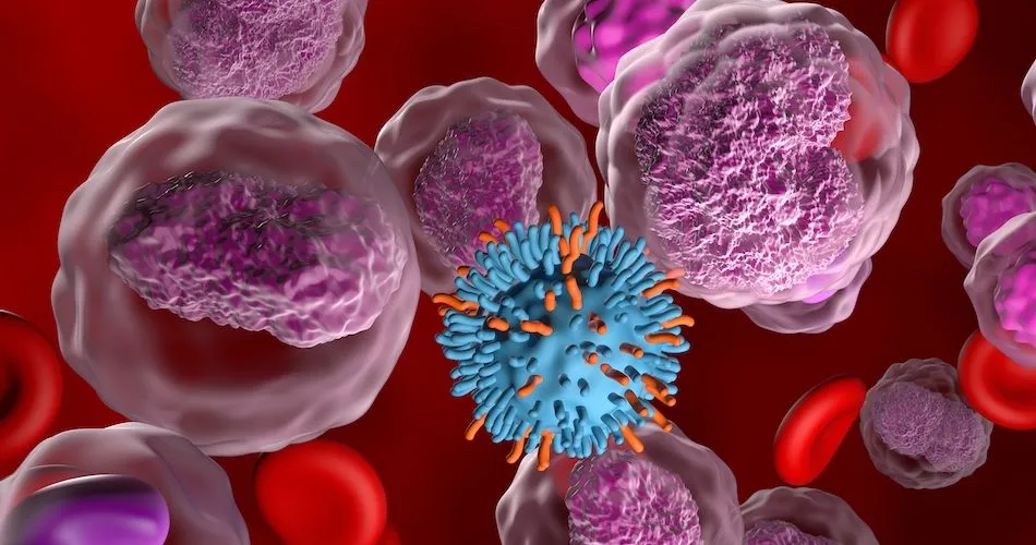 Is CAR T-cell Therapy More Effective for Transformed Follicular Lymphoma or De Novo DLBCL? image