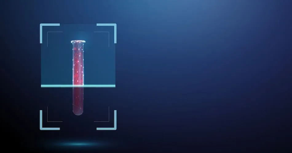 Blood-Based MRD Testing in Myeloma image