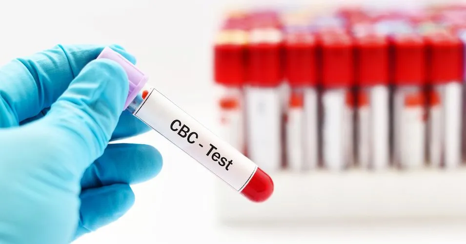 What is a Complete Blood Count (CBC) Test for CLL? image