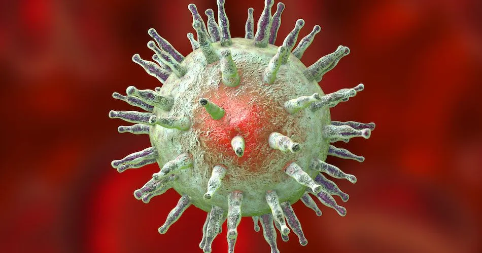The Link Between Epstein-Barr Virus and Hodgkin Lymphoma image