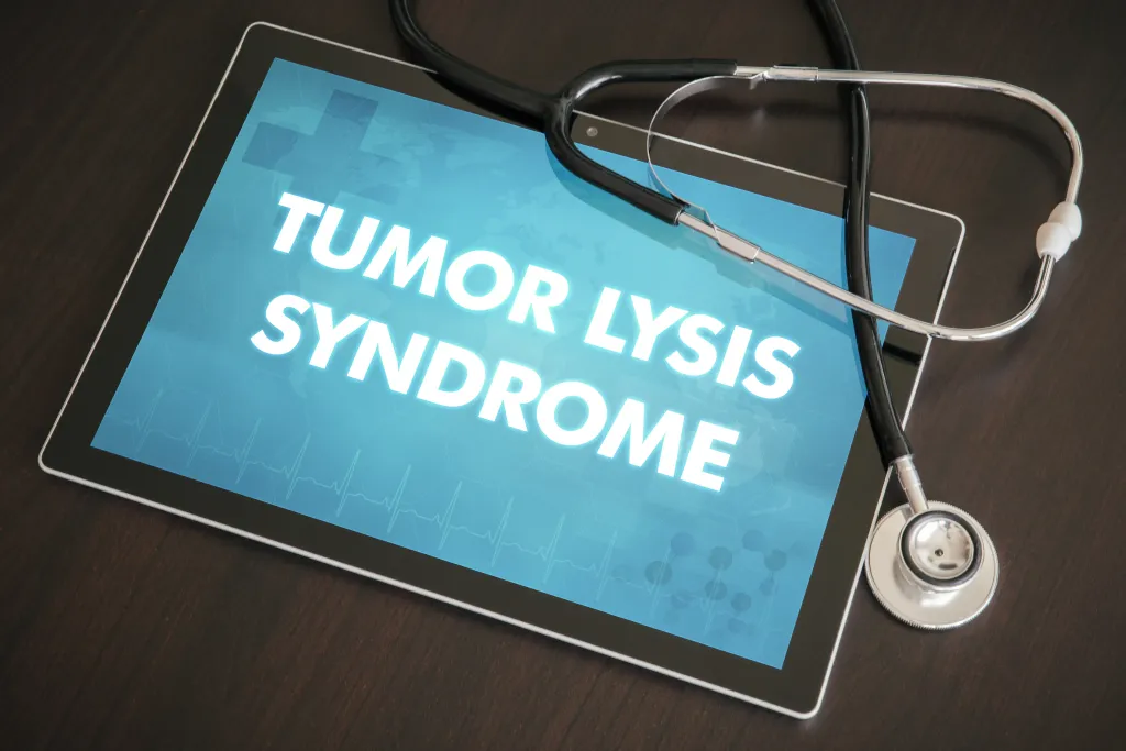 Study Identifies Risk Factors for Tumor Lysis Syndrome in Non-Hodgkin Lymphoma image
